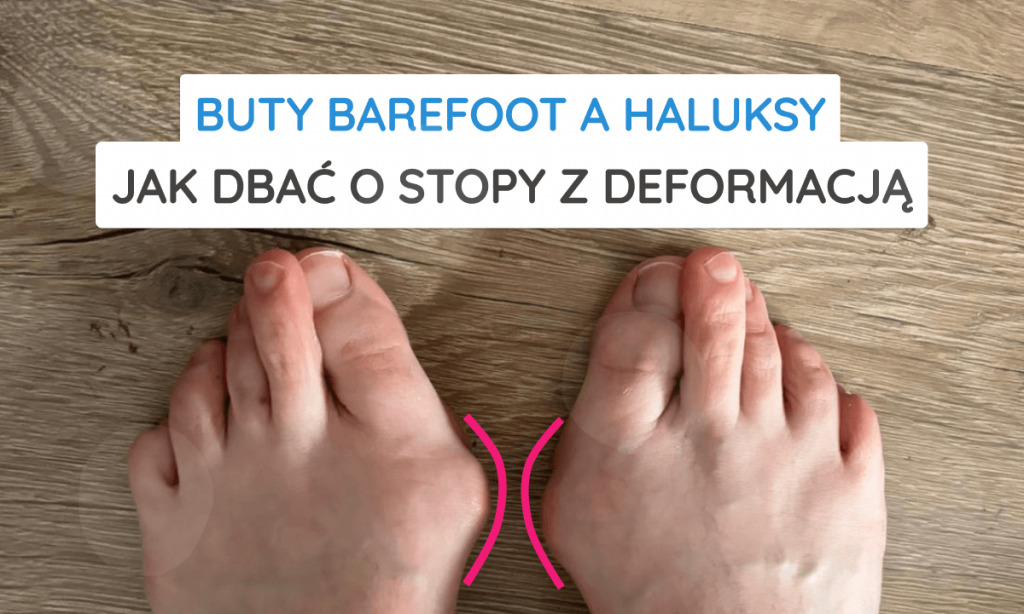 Buty barefoot a haluksy – jak dbać o stopy z deformacją