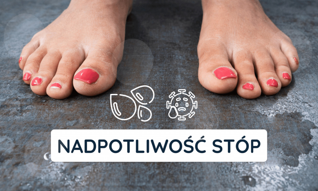 Spocone stopy, duży problem – podolog w walce z nadpotliwością
